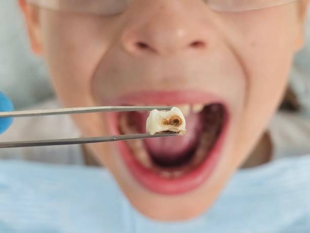 Best Pediatric Emergency Dentist in St Michaels, MD