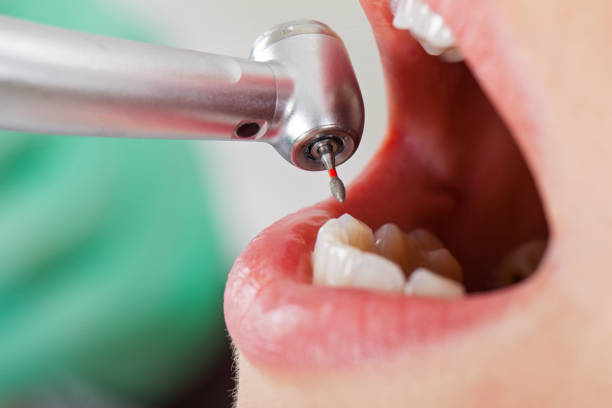 Best Weekend Emergency Dentist in St Michaels, MD